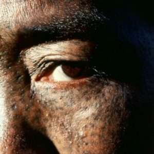Vanishing Tribes Of Burma: Chin4